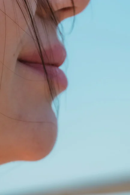 Dudak Kaldırma (Lip Lift)